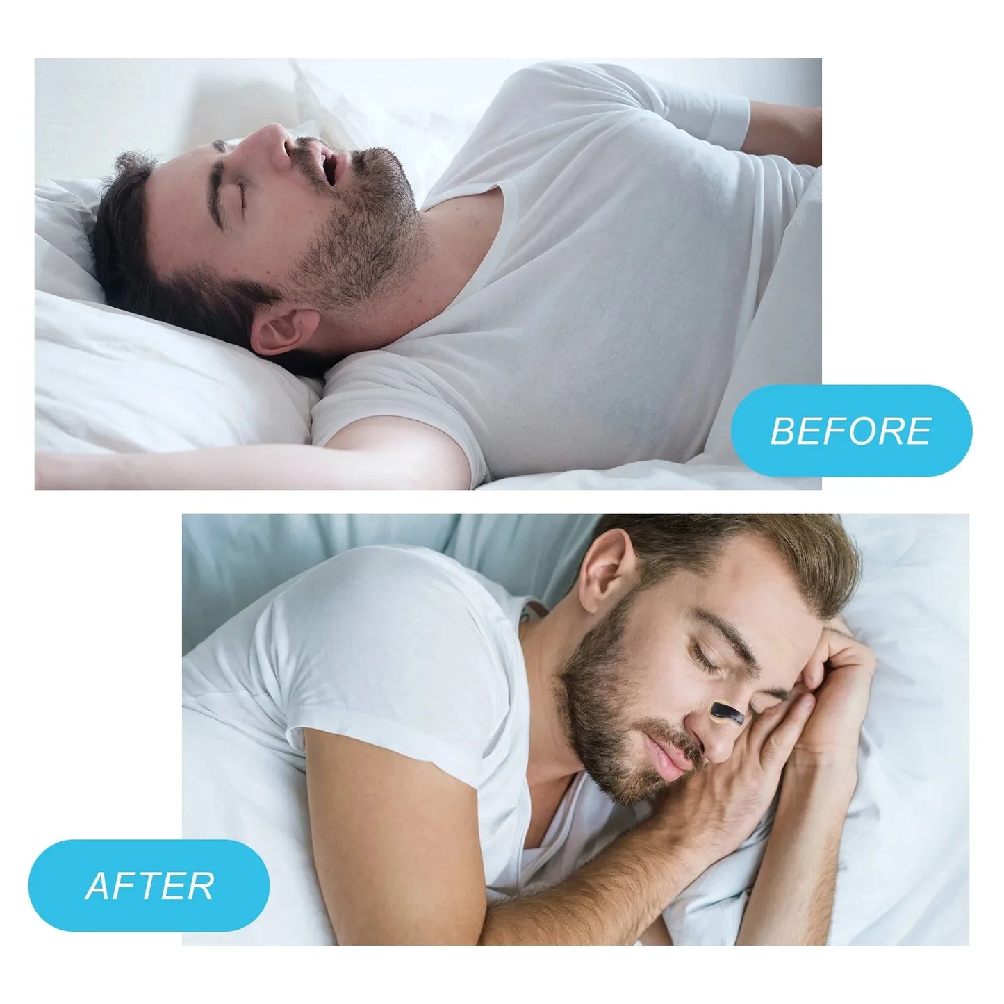 ✨ Magnetic Nasal Dilator Anti-Snoring Strips – Boost Oxygen & Improve Sleep 🔷 موسّع أنف مغناطيسي مضاد للشخير – شرائط لتسهيل التنفس وزيادة الأوكسجين أثناء النوم