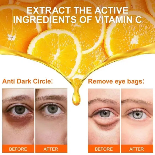 New Anti Dark Circles Under The Eyes Lutein Eye Essence Oil Exquisite Skin Eliminate Wrinkles Around The Eyes Reduce fine lines