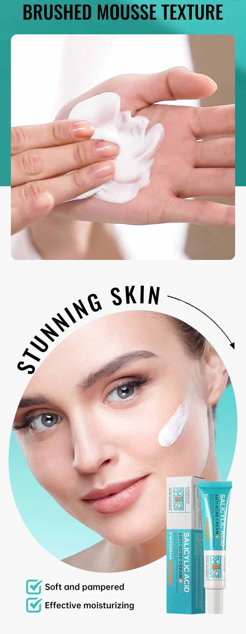 Salicylic Acid Acne Serum Cream Effective Treatment Hip Butt Acne Face Acne Back Acne Fade Acne Marks Whitening Smooth Skin Care