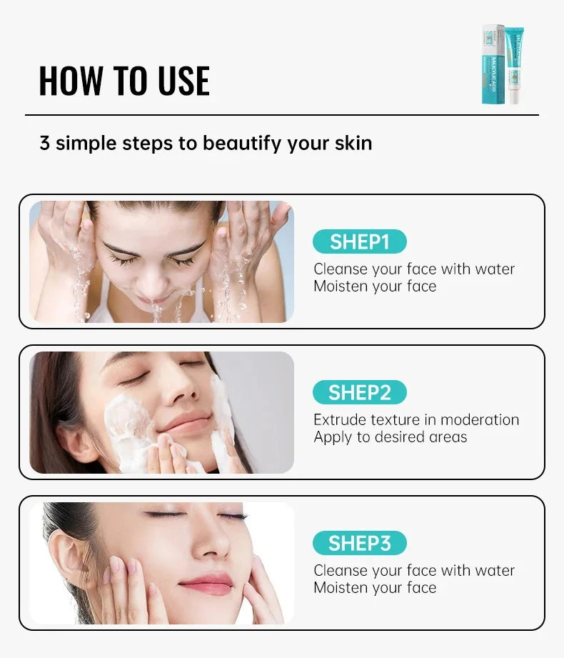 Salicylic Acid Acne Serum Cream Effective Treatment Hip Butt Acne Face Acne Back Acne Fade Acne Marks Whitening Smooth Skin Care