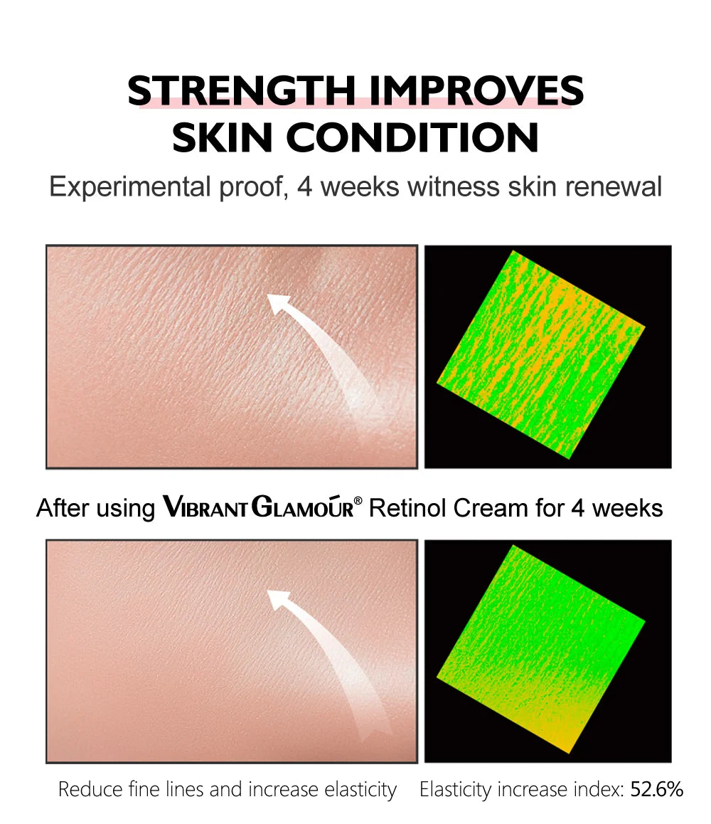 Retinol Face Cream Anti-Aging Remove Wrinkle Firming Lifting Whitening Brightening Moisturizing Hyalronic Acid Facial Skin Care