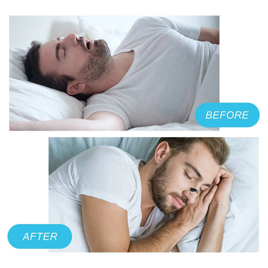 ✨ Magnetic Nasal Dilator Anti-Snoring Strips – Boost Oxygen & Improve Sleep 🔷 موسّع أنف مغناطيسي مضاد للشخير – شرائط لتسهيل التنفس وزيادة الأوكسجين أثناء النوم