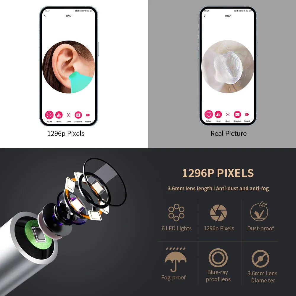 ✨ HD WiFi Ear Cleaner with Camera – 6 LED Lights, 3.6mm Lens, Photo & Video 🔷 جهاز تنظيف الأذن بكاميرا عالية الدقة و6 أضواء LED – عدسة 3.6 مم مع تصوير فيديو وصور