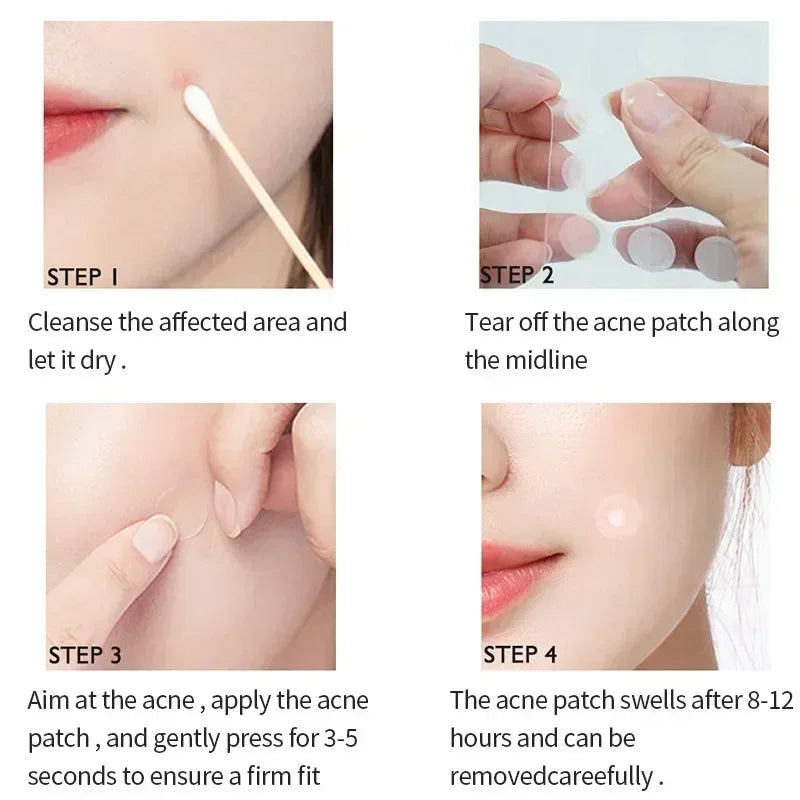 لاصقات الحبوب الشفافة – طبيعية وآمنة للبشرة | Invisible Acne Patches – Natural & Skin-Safe