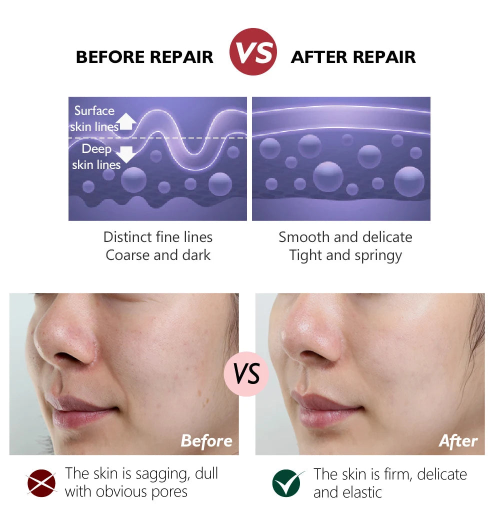 Retinol Face Cream Anti-Aging Remove Wrinkle Firming Lifting Whitening Brightening Moisturizing Hyalronic Acid Facial Skin Care