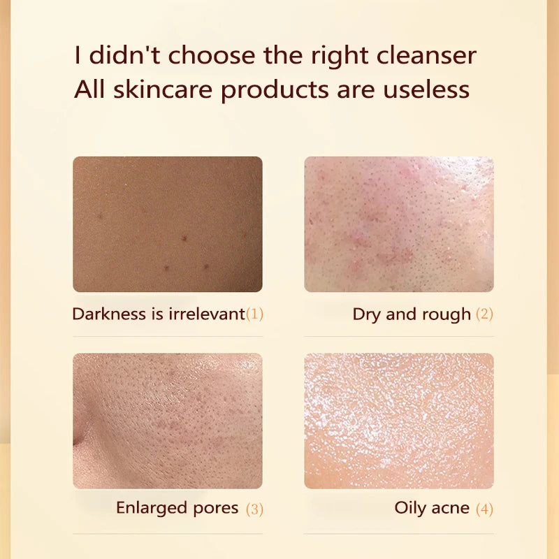 Vitamin C Facial Cleanser Skin Deep Cleansing Moisturizing Blackhead Removal skincare Face Wash Foam Face Cleanser Skin Care