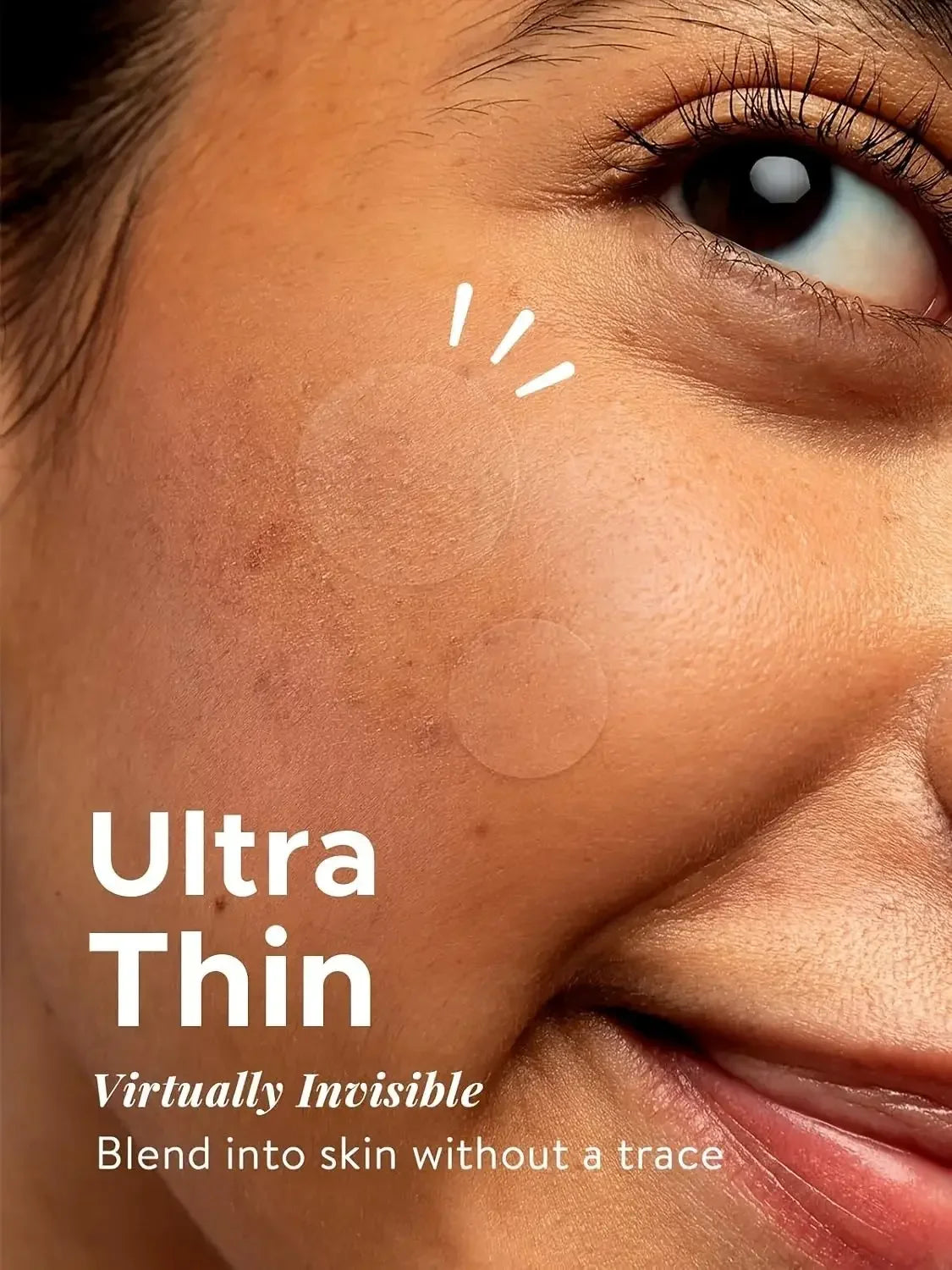 360PCS Invisible Acne Patches – Spot Treatment Stickers