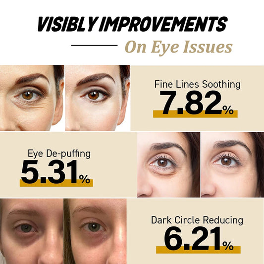 Snail Peptide Eye Cream Stick Reduce Dark Circles Eye Bags Firming Eye Brightener Anti Aging Nourishing Moisturize Eye Cream