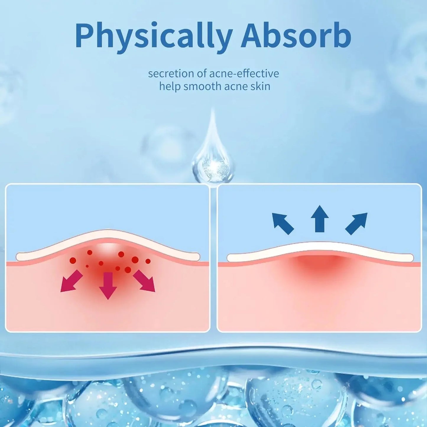 360PCS Invisible Acne Patches – Spot Treatment Stickers