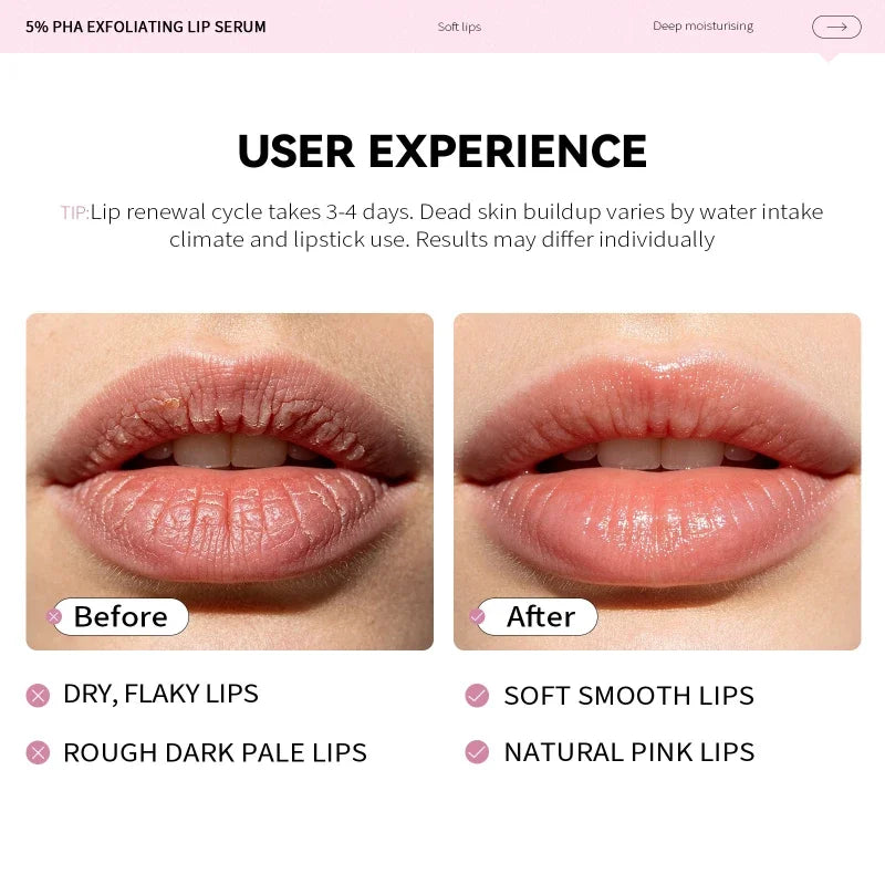 PHA 5% Exfoliating Lip Serum 10ml Nourishing And Plumping Lip Serum Relieves Dry Lips Gentle Non Irritating Repair Lips Essence