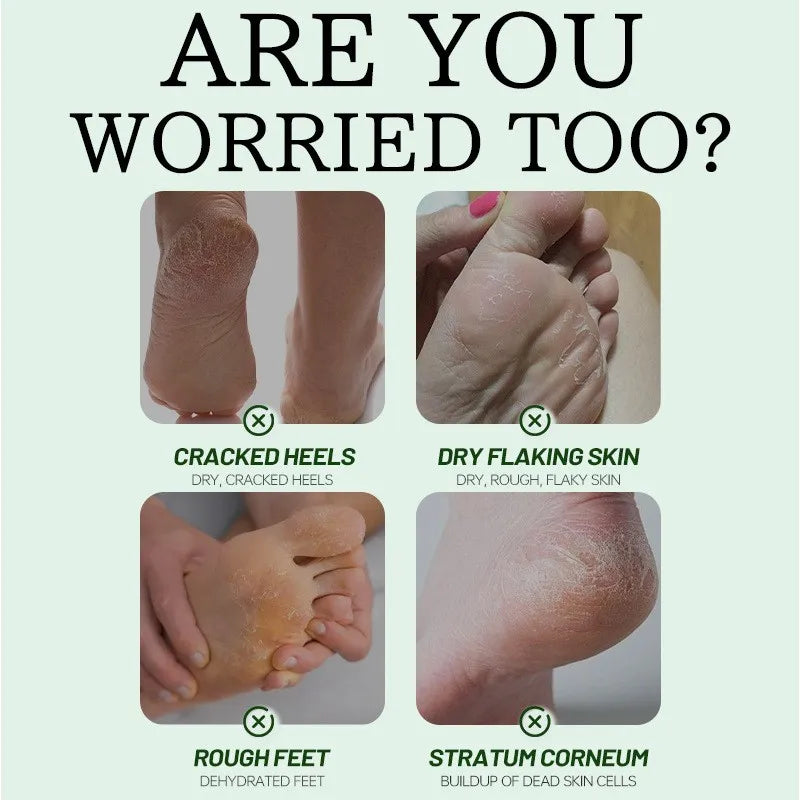 Tea Tree Oil Moisturizing Foot Cream 55g Aloe Vera Soothe Nourishing Smoothing Dry Heels Hydrate And Non-sticky Foot Care
