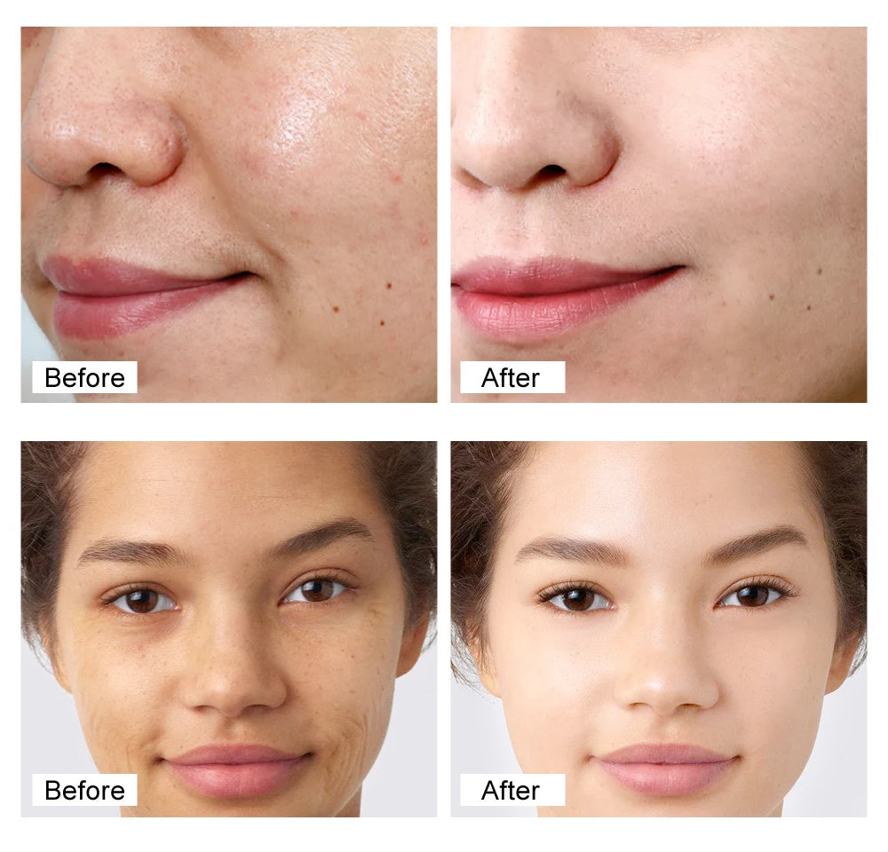 Retinol Face Cream Anti-Aging Remove Wrinkle Firming Lifting Whitening Brightening Moisturizing Hyalronic Acid Facial Skin Care