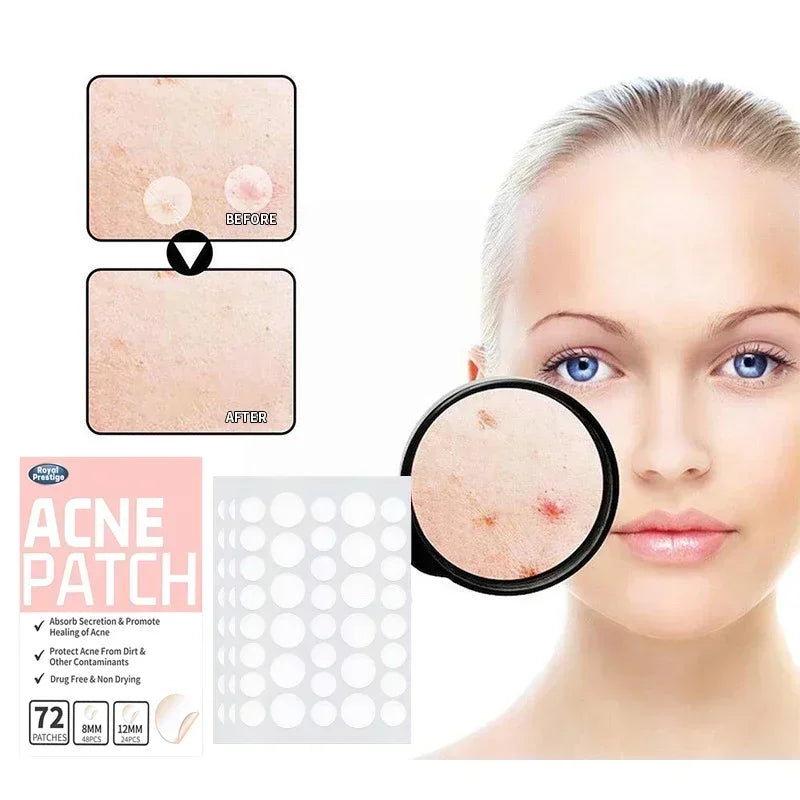 Invisible Hydrocolloid Acne Patches – 72 to 720 PCS