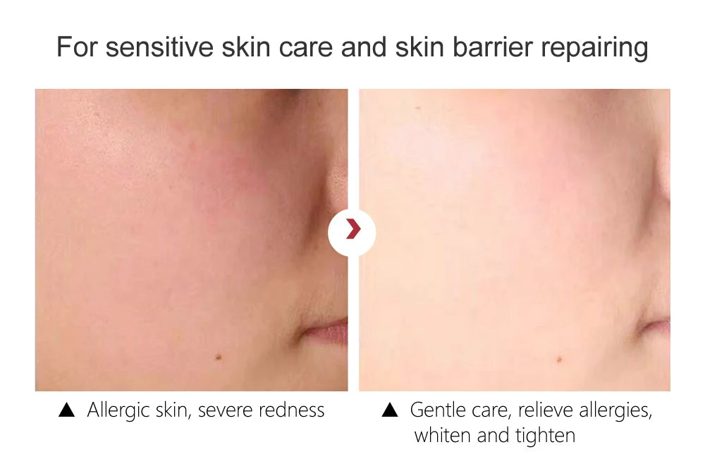 Retinol Face Cream Anti-Aging Remove Wrinkle Firming Lifting Whitening Brightening Moisturizing Hyalronic Acid Facial Skin Care
