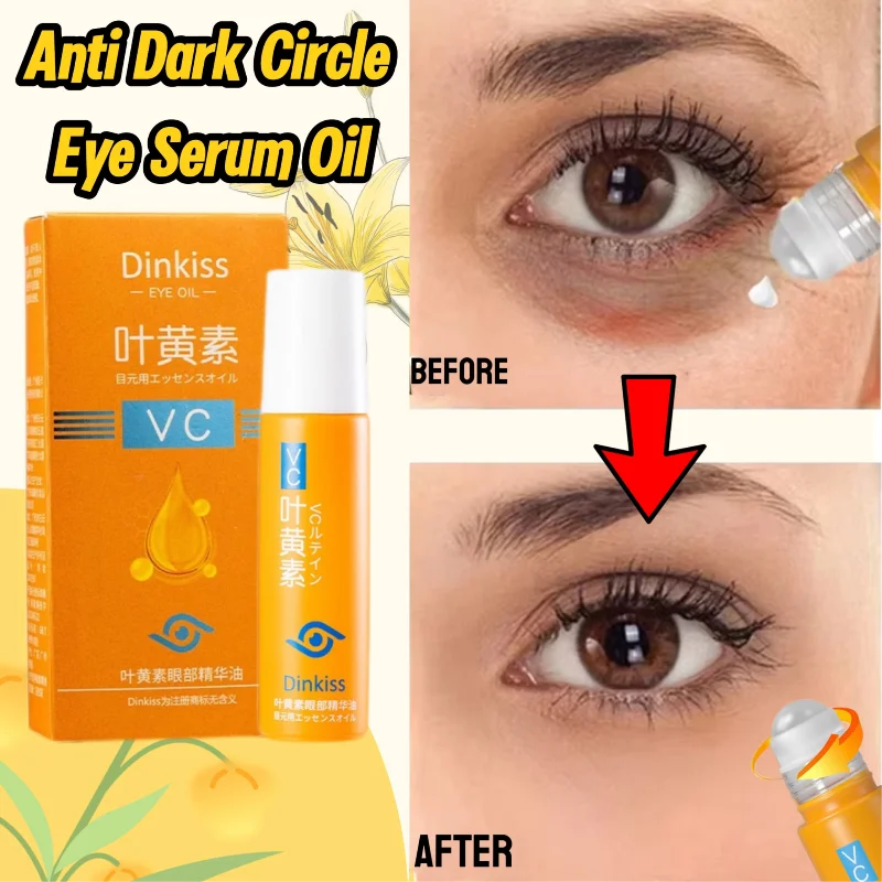 New Anti Dark Circles Under The Eyes Lutein Eye Essence Oil Exquisite Skin Eliminate Wrinkles Around The Eyes Reduce fine lines