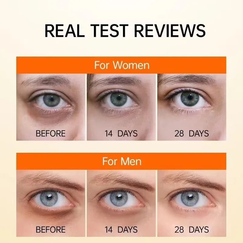 New Anti Dark Circles Under The Eyes Lutein Eye Essence Oil Exquisite Skin Eliminate Wrinkles Around The Eyes Reduce fine lines