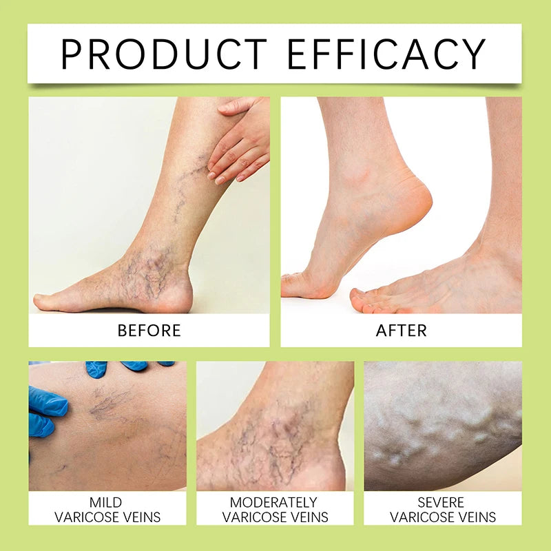 Miracle Balm 30g Natural Herbal Soothing Massage Cream Vitamin E Repairing Hydrating Legs And Feet Daily Body Care Cream