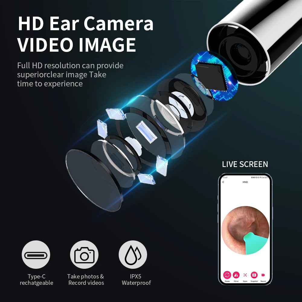 ✨ HD WiFi Ear Cleaner with Camera – 6 LED Lights, 3.6mm Lens, Photo & Video 🔷 جهاز تنظيف الأذن بكاميرا عالية الدقة و6 أضواء LED – عدسة 3.6 مم مع تصوير فيديو وصور